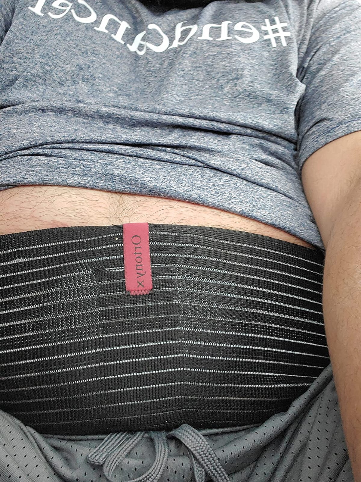 ORTONYX Umbilical Hernia Belt for Men and Women, Abdominal Binder L-XXL customer photo 1