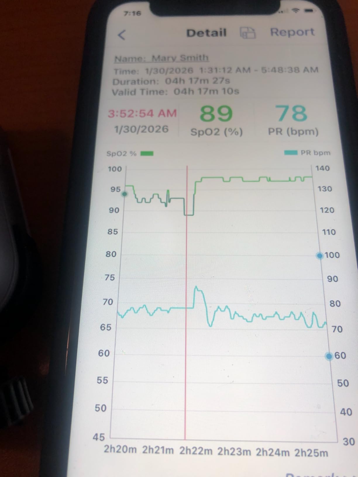 EMAY Sleep Oxygen Monitor with Built-in Recording Capability | Track Continuous Blood Oxygen Levels & Pulse Rate Overnight | Provides Sleep Report & Raw Data customer photo 1