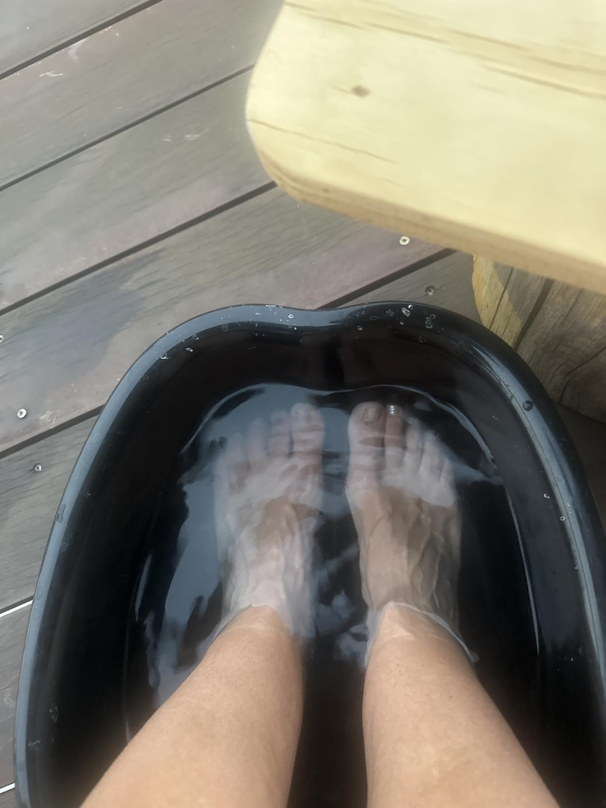 AllSett Health Foot Soaking Bath Basin – Large Size for Soaking Feet | Pedicure and Massager Tub for At Home Spa Treatment | Callus, Fungus, Dead Skin Remover customer photo 1